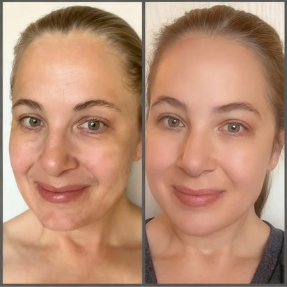 SenerisLabs Bakuchiol Renewal Óleo-Sérum Retinol-Free