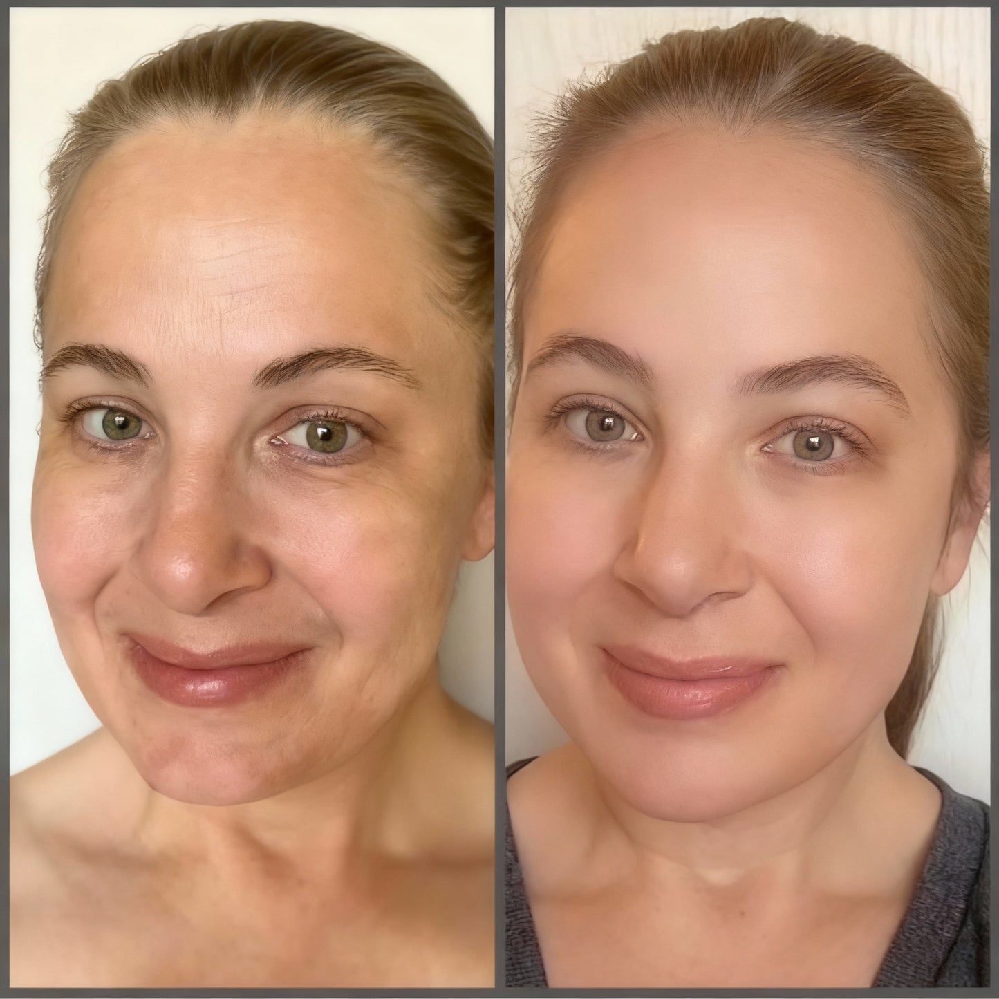 SenerisLabs Bakuchiol Renewal Óleo-Sérum Retinol-Free